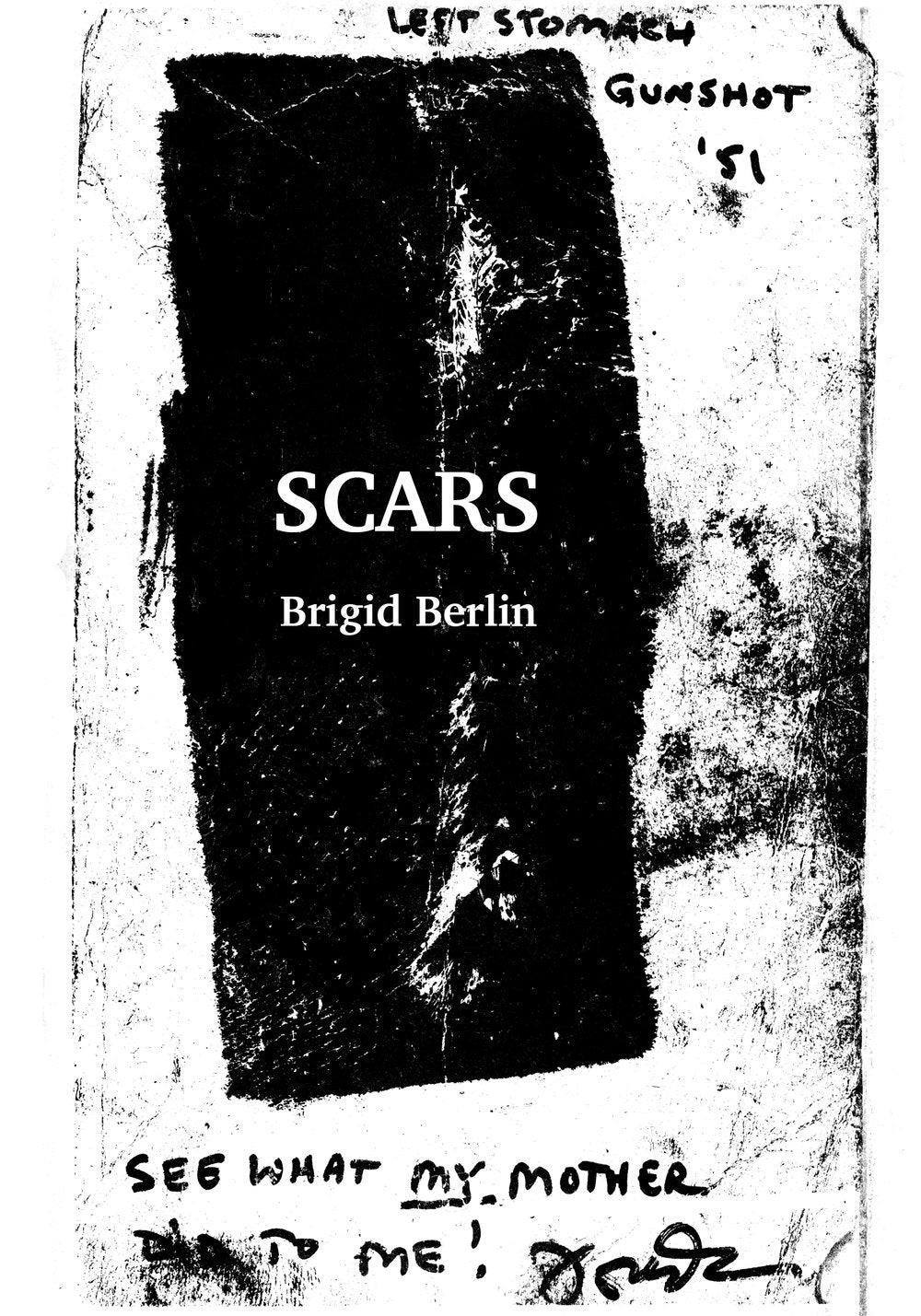 SCARS by Brigid Berlin